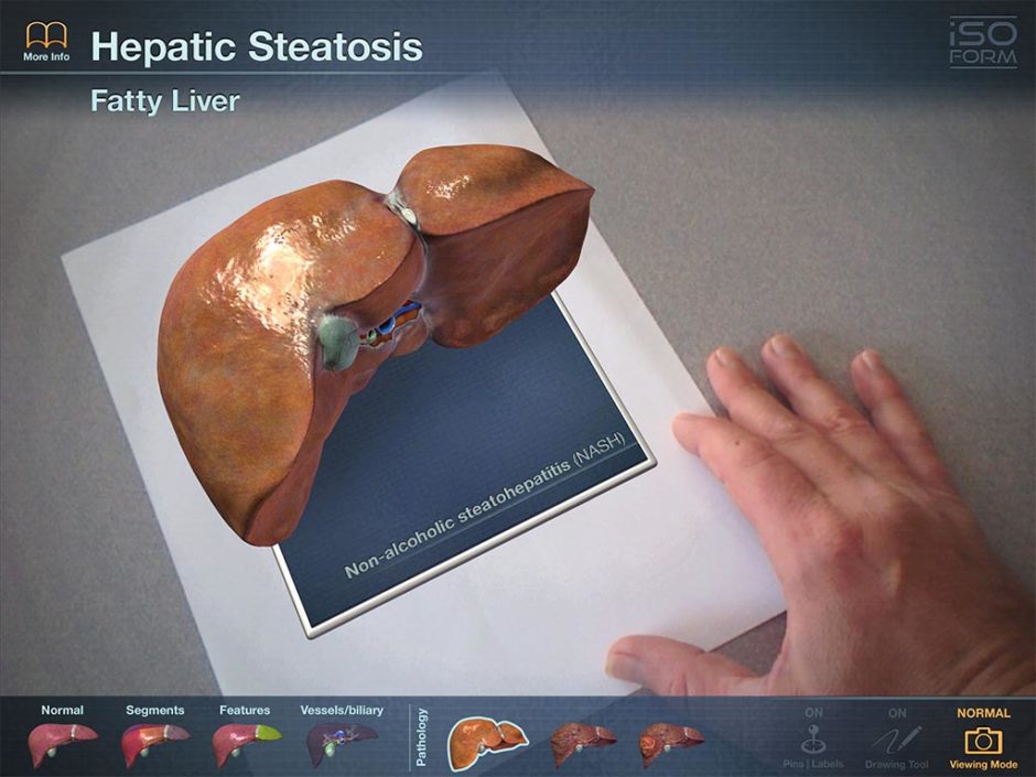 An Augmented Reality image of a liver using the AR Liver Viewer App